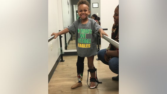 8-year-old injured in lawn mowing accident plays football after finding perfect prosthetic fit