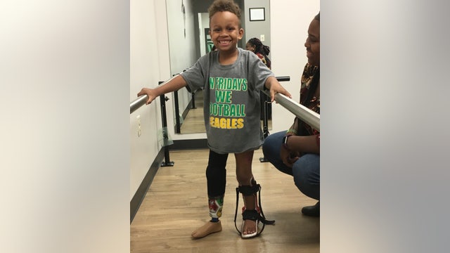 8-year-old injured in lawn mowing accident plays football after finding perfect prosthetic fit