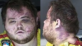 Colorado gay club shooting suspect, visibly injured by patrons, held without bail