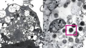 New Omicron subvariant becoming dominant COVID strain in U.S.