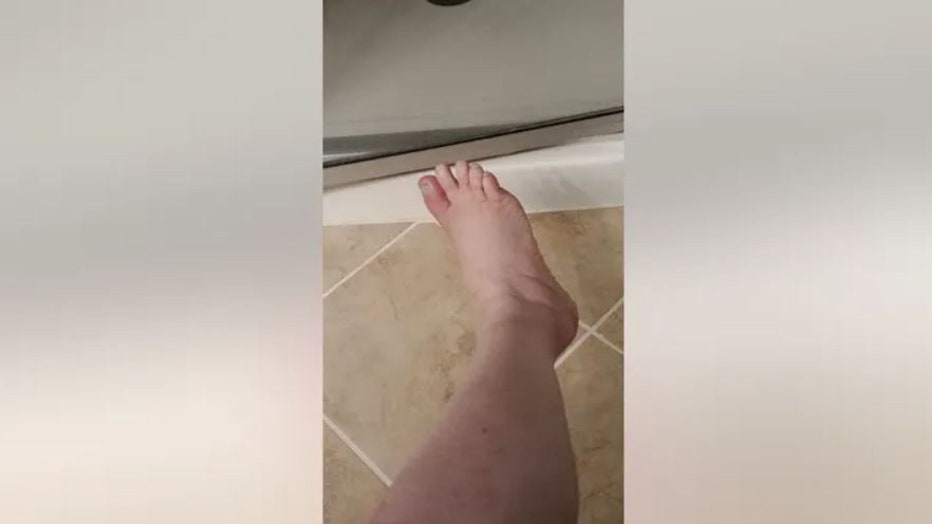 Georgia-woman-loses-toe-pedicure-IV.jpg