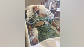 Mother of son injured in drunk driving incident urges others to be careful during spring break