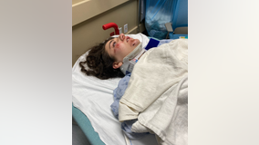 Woman hit by car while riding scooter in Austin; APD not investigating incident as hit-and-run