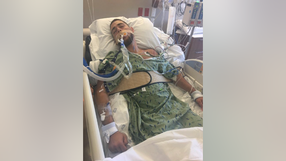 Mother of son injured in drunk driving incident urges others to be careful during spring break