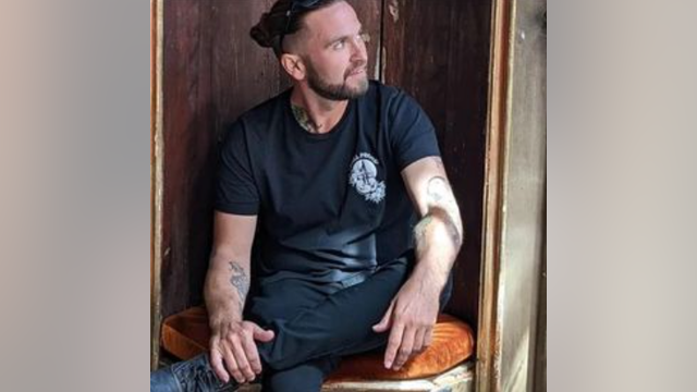 Bicyclist recovering after he was nearly killed after hit-and-run in East Austin