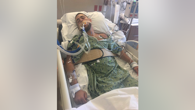 Mother of son injured in drunk driving incident urges others to be careful during spring break