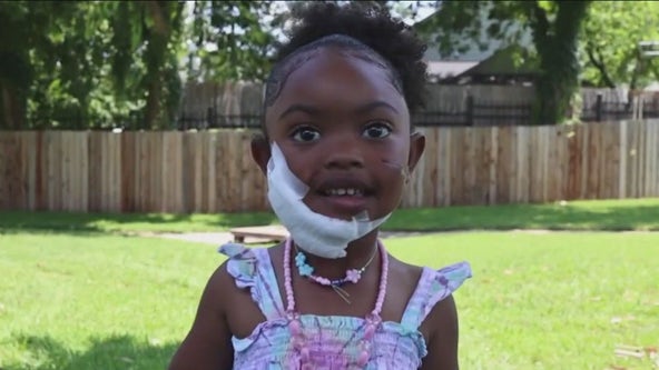 Dog attacks 4-year-old girl in Austin; owner being evicted by city