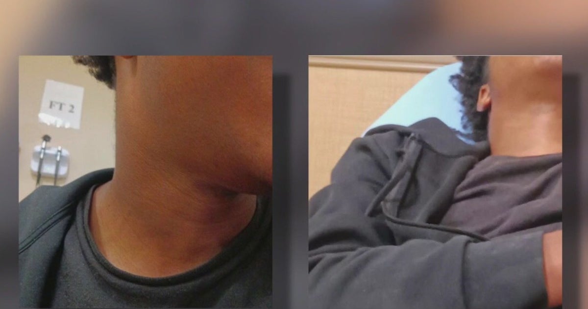 Teen injured by Austin police after mistakenly identified as suspect ...