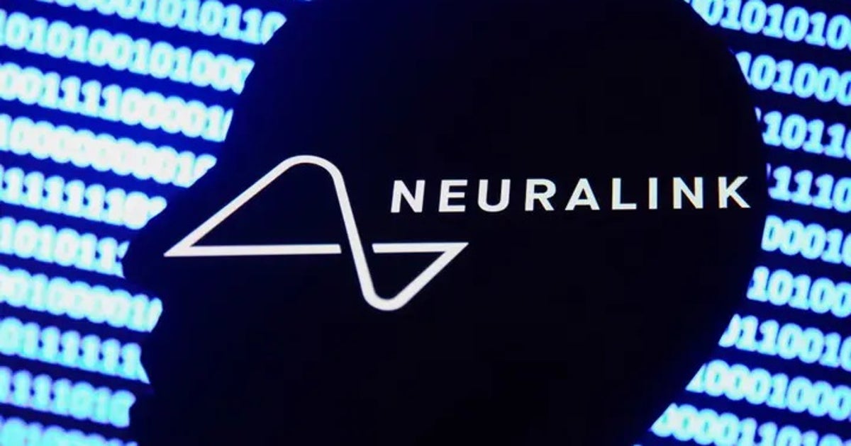 Elon Musk says first human patient will soon receive Neuralink brain implant