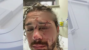 Austin man sues Rainey Street bar after drunk patron attacked him