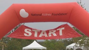 Hundreds turn out for Austin Kidney Walk to support those with kidney disease