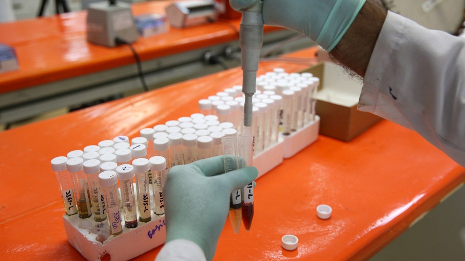 a2881ea7-GETTY-Toxicology-Test-2-111523.jpg