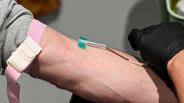 STI testing urged as public health officials see rising infection numbers