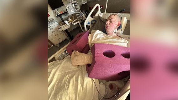 Austin machete attack victim up and walking; more surgeries planned: mother