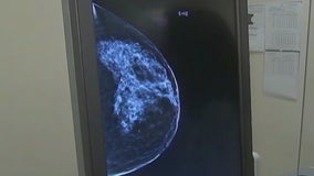 Austin doctor speaks on importance of mammograms during Breast Cancer Awareness Month