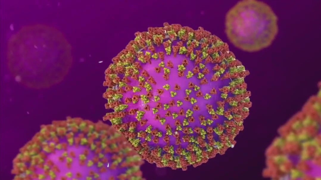 Measles case reported in Travis County; first since last year