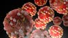 Measles in Texas: Leander child first case in Williamson County