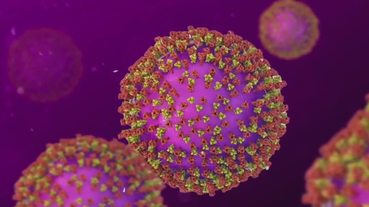 Measles case reported in Travis County; first for 2026