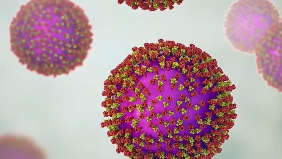 Measles in Texas: Austin-Travis County wastewater surveillance detects traces of virus