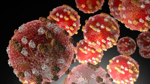 Measles in Texas: Leander child first case in Williamson County