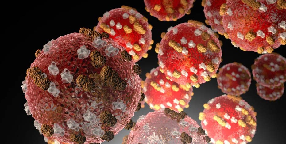 Measles in Texas: Unvaccinated infant in Austin tests positive for virus