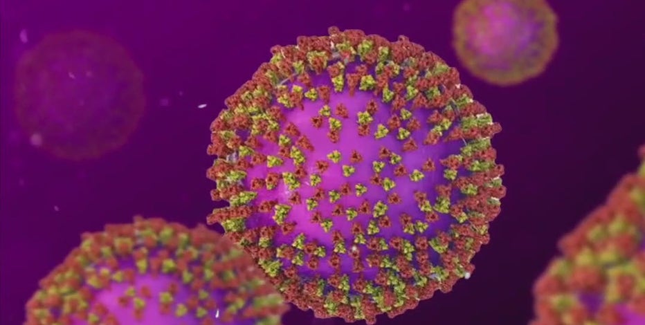 Measles in Texas: Second case reported in Travis County