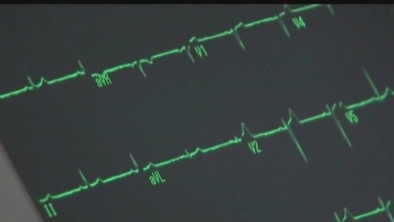 Does daylight saving time have effects on heart health?