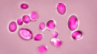 Texas leads US in cases of dangerous fungal infection