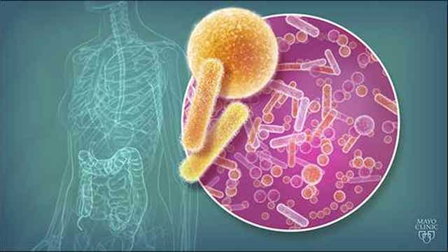 Mayo Clinic: Gut bacteria may lead to multiple sclerosis treatment