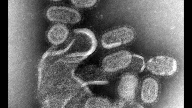 4th Minnesota child dies of influenza