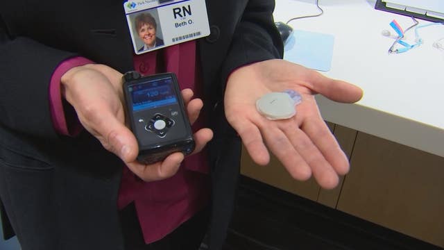 'Game changer' device for Type 1 diabetes patients mimics pancreas