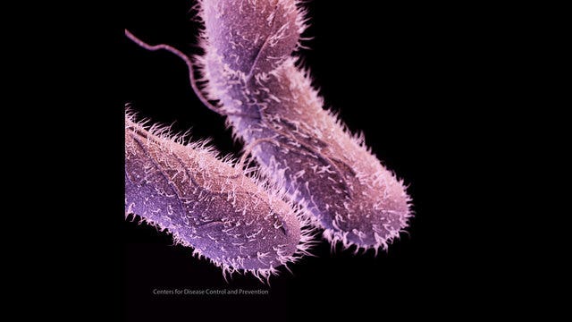 Salmonella infections linked to raw turkey products, 90 sickened nationwide