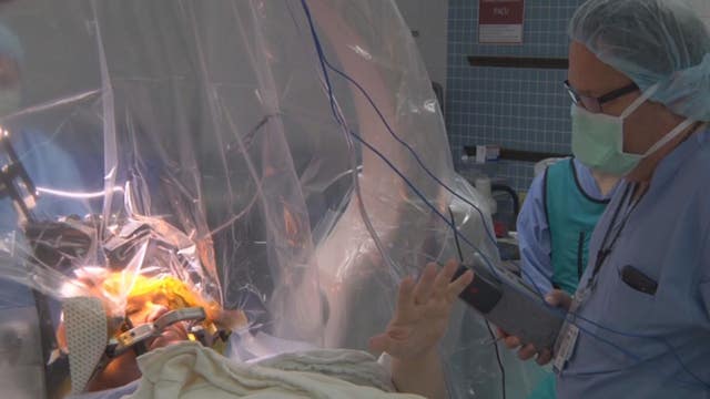 'Pacemaker' for the brain a life-changer for Maplewood, Minn. man