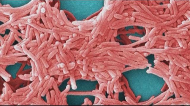 MDH: 4 Legionnaires' disease cases possibly linked to Crookston hotel