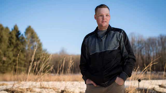 Wyoming man gets life-changing face transplant at Mayo Clinic