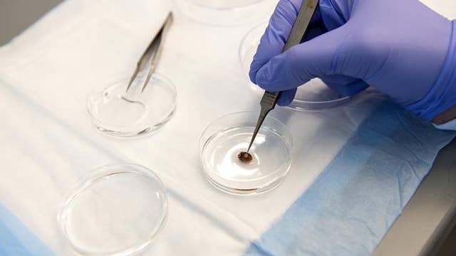 U of M researchers develop 3-D printed patch could help heart attack patients