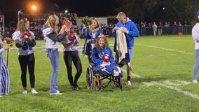 St. Croix Falls, Wis. teen who had legs amputated after fiery crash crowned homecoming queen