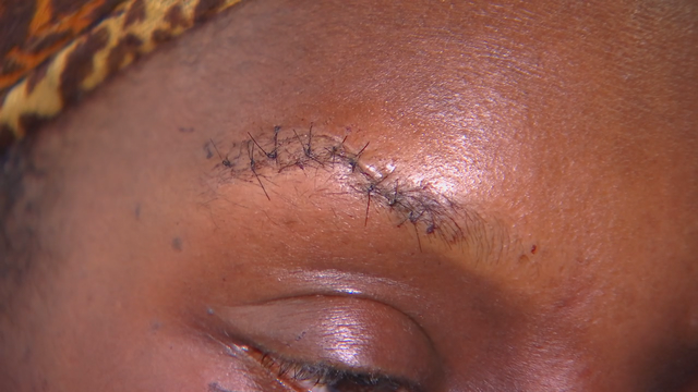 Mother, coach says she was attacked at 10-year-old son’s football game