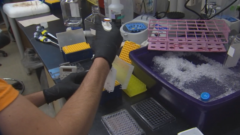 HIV vaccine research