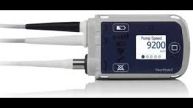FDA: 26 people died while replacing controller for blood pump