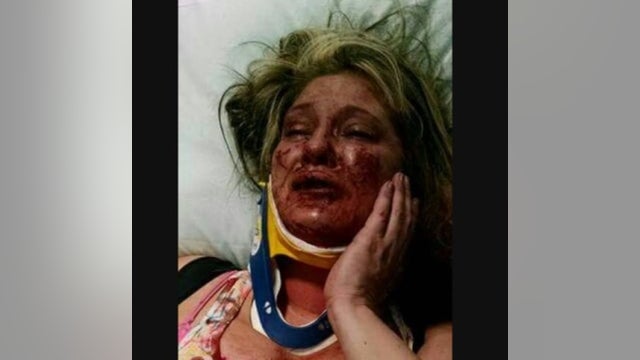 Victim: DA went easy on Wis. motorcycle club that attacked her