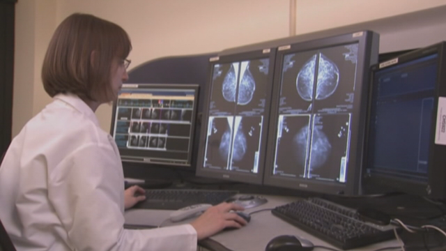 American Heart Association: Radiation, chemotherapy increase risk of heart failure