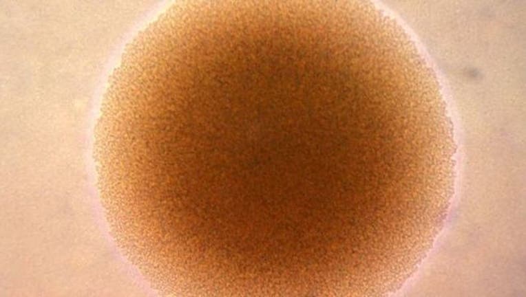 c4e5e538-super-gonorrhea-404023.jpg