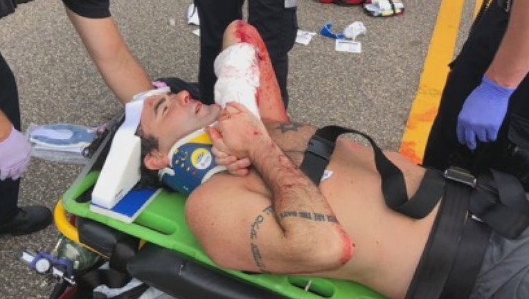 driver hits jogger