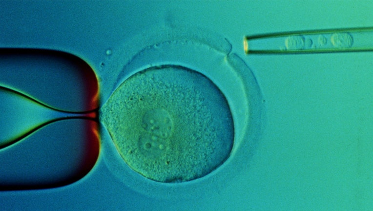 17c0e35f-GETTY stem cell 030519_1551787094813.jpg-401385.jpg