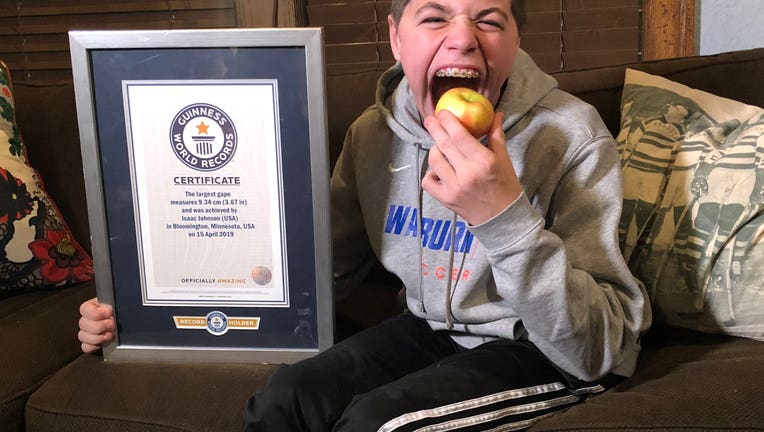 teen with World's Largest Mouth