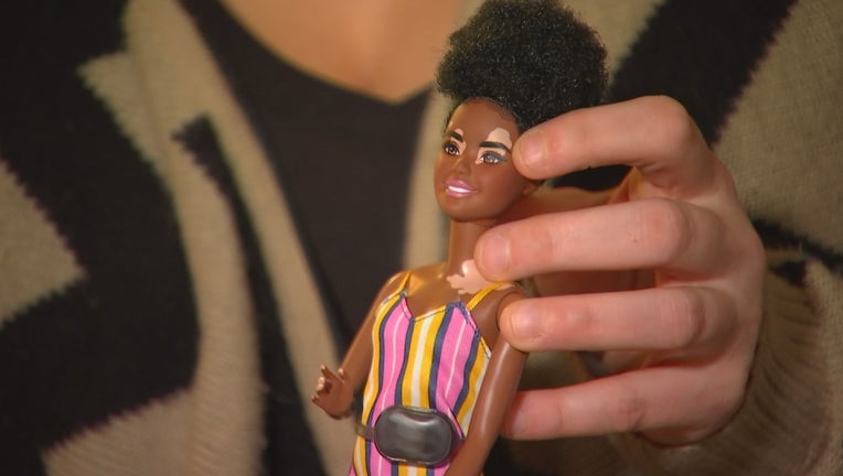barbies with vitiligo
