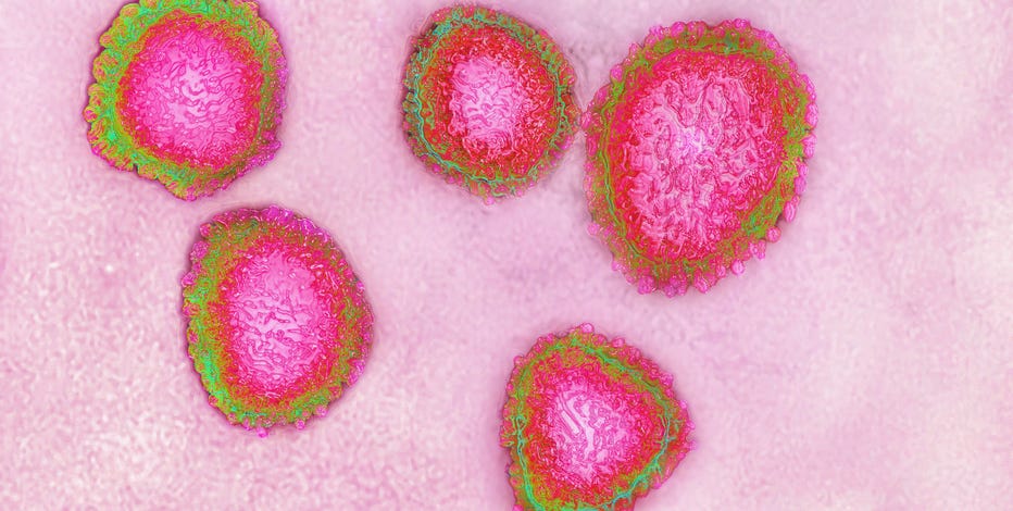 4 reasons why you should care about the coronavirus outbreak