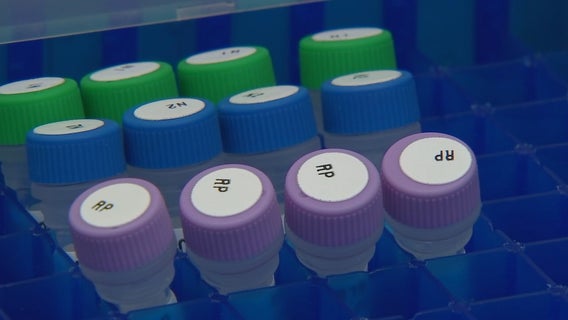 COVID-19 in Wisconsin: More than 11,000 cases, 434 deaths to date