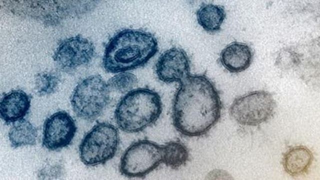 Minnesota reports 4 more COVID-19 deaths, 426 new cases Wednesday